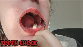 Dental Mirror And Hook Teeth Inspection Fetish Exploring My Mouth And Showing Every Tooth In Close Up