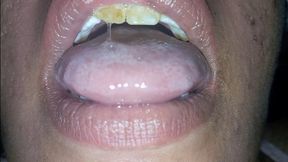 Mouth, Tongue and Uvula.