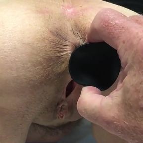 Removing Big Butt Plug From 60 Year Old Wife MILF GILF Granny Mature Anal
