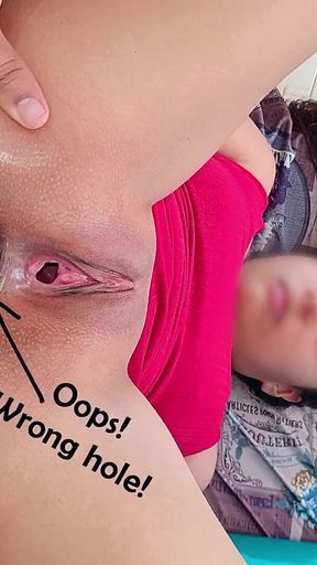 My Idiot Boyfriend Took the Wrong Hole and Broke My Ass