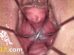 Gaping and gyno dildoing her graceful hole