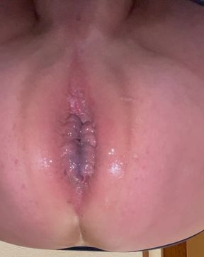 Gaping ass hole