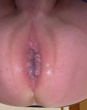 Gaping ass hole