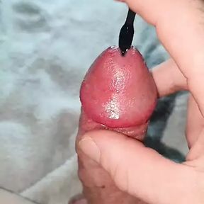 With a dilator in the sore cock