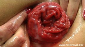 'Dirty anal&#x1F44C; play, prolapse pleasure & big black plug invasion gone wrong'