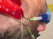 Horny deepthroat full of spit with braces and double headgear