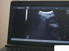 Tiny twink barebacked on ultrasound at doctors infirmary