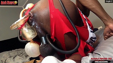 Asshole Punched tf Out - Ass Monkey XL Inflatable Buttplug Angle 2 Part 2