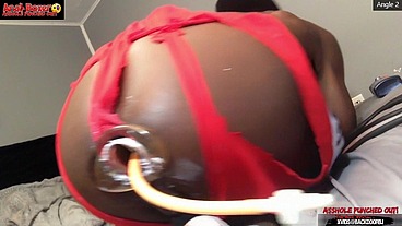 Asshole Punched tf Out - Ass Monkey XL Inflatable Buttplug Angle 2 Part 2