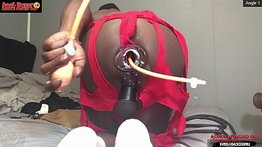 Asshole Punched tf Out - Ass Monkey XL Inflatable Buttplug Angle 2 Part 2