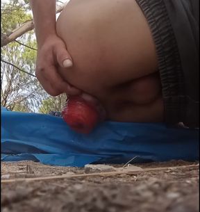 Prolapse