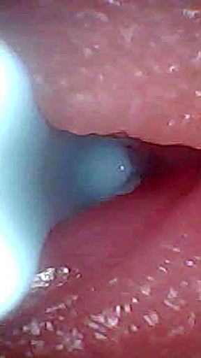 Unforgettable moment from &quot;I couldn&#039;t believe what happens INSIDE the penis as sperm passes through (endoscopic footage)&quot;