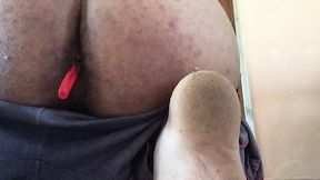 Lisbean doctor fuck a patient with hard cock and fuck his pussy ass #suck ass #pussy and vagina