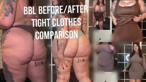 BBL Tight Clothes Comparison Before and After Surgery
