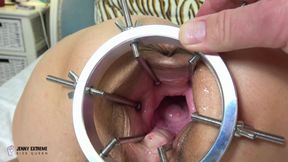 What's Inside of Me