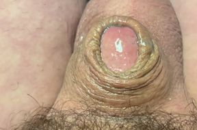 Micro penis pre- cum over flow