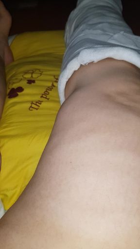 Wiggling My Toes in Cast