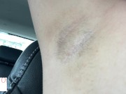 armpit hair even after laser removal - glimpseofme