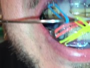 Cumming on my twinblock full of elastics and put it on my mouth