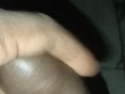 A milky discharge