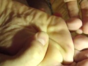 needle on my soles & between toes