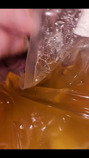 Cripple Problems 101: I Have to Drain Using a Catheter Because My Bladder Was Not Releasing