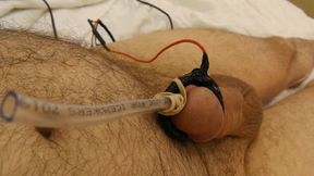 Electro with cum catheter