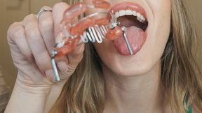 Try On: Custom Retainer with Tongue Crib and Lip Bumpers