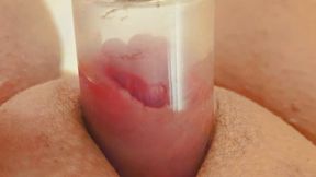 Up Close: Nellie's Big Clit Pic Slideshow