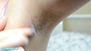 Fuzzy Underarm