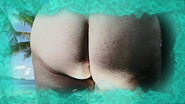 Beach Sunburn BBW