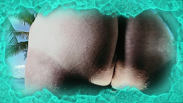 Beach Sunburn BBW