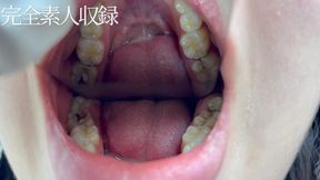 Amateur ?Oral Fetish – No Sexual Experience, Raised at a Prestigious All-Girls School – Every Detail Inside Her Mouth Revealed.