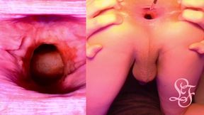 Split Screen Look Inside Lina's Gaping Ass with Eggs