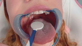 CLOSEUP MOUTH EXAM