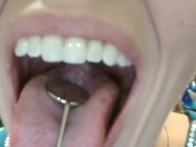 Tongue and Throat Exam (with and without flashlight)