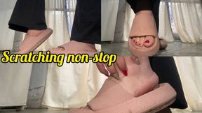 Scratching non-stop + hard skin on the heels