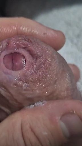 Uncut Tight Phimosis Cock Foreskin Stretched Close up
