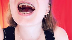 ASMR with braces - chewing jelly bears - vore fetish