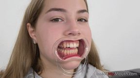 Inside My Mouth - Adele - Mouth retractor clip (FULLHD quality)