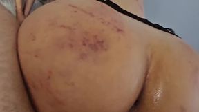 I'd gladly ravage her ravaged rear, a nasty aftershock of a BDSM bash