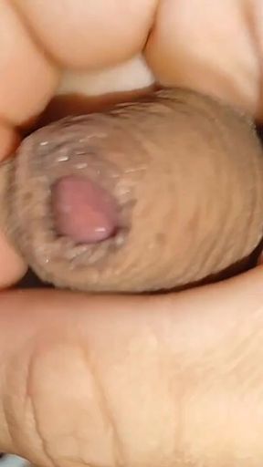 Cumshot of the Largest Phimosis Foreskin in the World.
