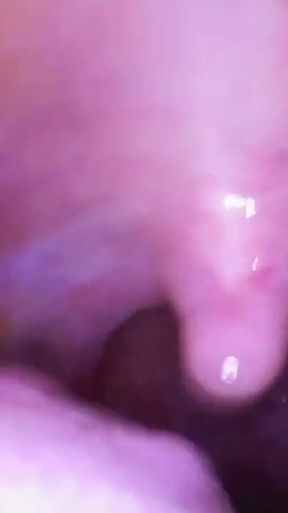 Deep Inside Sydney's Mouth - Sydney Screams Shows off Mouth, Tongue, Throat, and Uvula with Endoscope