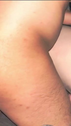Smooth Skin