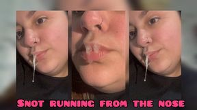 White snot running from the nose