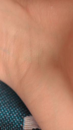 The Skin of My Armpits Is so Delicate