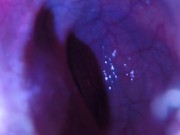 POV - The view staring up my descending colon as I mush you from the outside