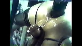 Extreme anal stretching