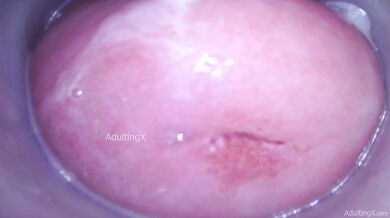Camera in my pussy deep gape with my cervix pulsing wet