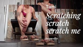 Woman scratches and scratches her feet due to severe itching (4)